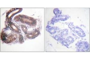 Immunohistochemistry analysis of paraffin-embedded human skin tissue, using HDAC3 (Ab-424) Antibody. (HDAC3 anticorps  (AA 379-428))
