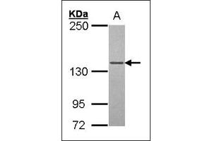 Western blot: Sample (30 µg of whole cell lysate). (POLG anticorps  (AA 829-1201))