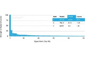 Analysis of Protein Array containing more than 19,000 full-length human proteins using Sarcomeric Actinin Alpha 2 Mouse Monoclonal Antibody (ACTN2/3293).