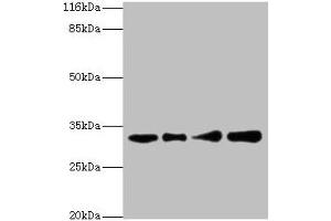 Western blot All lanes: RSU1 antibody at 2 μg/mL Lane 1: Human placenta tissue Lane 2: Caco-2 whole cell lysate Lane 3: Jurkat whole cell lysate Lane 4: HepG2 whole cell lysate Secondary Goat polyclonal to rabbit IgG at 1/10000 dilution Predicted band size: 32, 26 kDa Observed band size: 32 kDa (RSU1 anticorps  (AA 117-277))