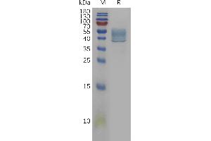 Human IL13(35-146) Protein, hFc Tag on SDS-PAGE under reducing condition.