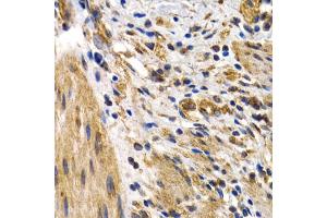 Immunohistochemistry of paraffin-embedded human normal colon using HSPB8 antibody (ABIN5971347) at dilution of 1/200 (40x lens). (HSPB8 anticorps)