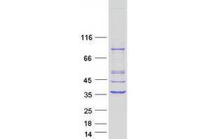 Validation with Western Blot