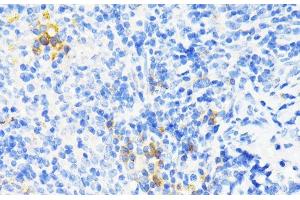 Immunohistochemistry of paraffin-embedded Mouse spleen using CAMP Polyclonal Antibody at dilution of 1:200 (40x lens). (Cathelicidin anticorps)