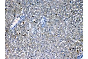 IHC analysis of Flt3 / CD135 using anti-Flt3 / CD135 antibody .