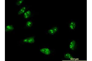 Immunofluorescence of monoclonal antibody to TASP1 on HeLa cell.