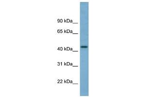 WB Suggested Anti-TRIM31 Antibody Titration: 0. (TRIM31 anticorps  (Middle Region))