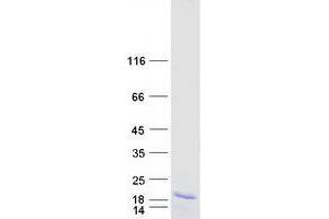 Validation with Western Blot