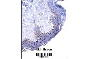 HOXC4 Antibody immunohistochemistry analysis in formalin fixed and paraffin embedded human skin tissue followed by peroxidase conjugation of the secondary antibody and DAB staining.