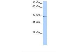 NUDT17 anticorps  (AA 168-217)