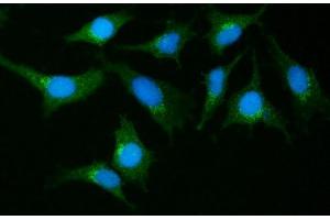 IF analysis of GIT1 using anti-GIT1 antibody (ABIN7601683). (GIT1 anticorps  (AA 415-736))