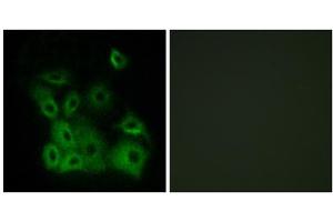 Immunofluorescence analysis of A549 cells, using BAX (Phospho-Thr167) antibody. (BAX anticorps  (pThr167))