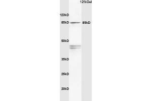 Rat brain lysates probed with Anti PI3K/PI3 kinase p85 alpha subunit Polyclonal Antibody, Unconjugated (ABIN725405) at 1:200 in 4 °C. (PIK3R1 anticorps  (AA 501-600))