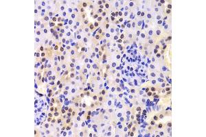 Immunohistochemistry of paraffin-embedded mouse kidney using HNRNPA1 Antibody (ABIN5975570) at dilution of 1/100 (40x lens). (HNRNPA1 anticorps)