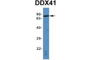 Host:  Rabbit  Target Name:  DDX41  Sample Type:  Human Fetal Heart  Antibody Dilution:  1. (DDX41 anticorps  (N-Term))
