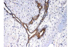 IHC analysis of NSF using anti-NSF antibody .