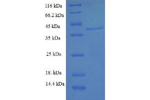 SDS-PAGE (SDS) image for Dual Specificity Phosphatase 13 (DUSP13) (AA 1-198), (full length) protein (His-SUMO Tag) (ABIN5711425)