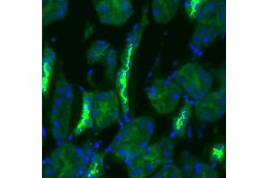 Immunohistochemistry analysis using Rabbit Anti-NCC Polyclonal Antibody (ABIN863201).