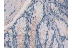 Detection of ERa in Mouse Small intestine Tissue using Polyclonal Antibody to Estrogen Receptor Alpha (ERa) (Estrogen Receptor alpha anticorps  (AA 233-483))