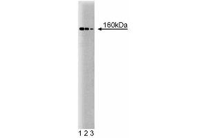Western blot analysis of ROCK-I on mouse kidney lysate.