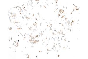 Immunocytochemistry (ICC) image for anti-Fibroblast Activation Protein, alpha (FAP) (AA 26-760) antibody (ABIN7453971)