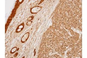 IHC-P Image Immunohistochemical analysis of paraffin-embedded 59T xenograft, using 14-3-3 sigma, antibody at 1:100 dilution.