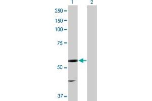 Western Blot analysis of EPHX2 expression in transfected 293T cell line by EPHX2 MaxPab polyclonal antibody. (EPHX2 anticorps  (AA 1-555))