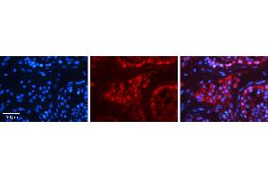 Rabbit Anti-HSPA4 Antibody   Formalin Fixed Paraffin Embedded Tissue: Human Testis Tissue Observed Staining: Cytoplasm in spermatogonia and Leydig cells Primary Antibody Concentration: 1:100 Other Working Concentrations: 1:600 Secondary Antibody: Donkey anti-Rabbit-Cy3 Secondary Antibody Concentration: 1:200 Magnification: 20X Exposure Time: 0. (HSPA4 anticorps  (N-Term))