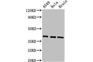 Western Blot Positive WB detected in: A549 whole cell lysate, Hela whole cell lysate, Mouse brain tissue All lanes: HLA-C antibody at 3. (HLA-C anticorps  (AA 62-306))