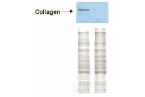 Western blot analysis is shown using ABIN116549, affinity purified anti-Collagen I antibody to detect expression of collagen I in Wistar rat hepatic stellate cell (HSC) in control -GFP transduced (left lane) and -PPARgamma transduced cell lysates (right lane). (Collagen Type I anticorps)