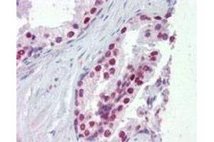 FOXA1 polyclonal antibody  (5 ug/mL) staining of paraffin embedded human prostate. (FOXA1 anticorps  (C-Term))