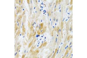Immunohistochemistry of paraffin-embedded mouse heart using PHPT1 antibody. (PHPT1 anticorps  (AA 1-125))
