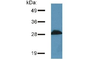 Detection of PRR7 / TRAP3 in murine brain lysate by Western blotting using the monoclonal antibody