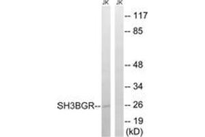 Western blot analysis of extracts from Jurkat cells, using SH3BGR Antibody. (SH3BGR anticorps  (AA 81-130))
