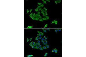 Immunofluorescence analysis of U2OS cells using TGM3 antibody (ABIN6132263, ABIN6149094, ABIN6149095 and ABIN6221560). (TGM3 anticorps  (AA 1-180))