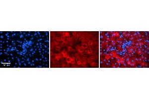 Rabbit Anti-GNB2L1 Antibody    Formalin Fixed Paraffin Embedded Tissue: Human Adult liver  Observed Staining: Cytoplasmic,Membrane Primary Antibody Concentration: 1:100 Secondary Antibody: Donkey anti-Rabbit-Cy2/3 Secondary Antibody Concentration: 1:200 Magnification: 20X Exposure Time: 0.