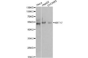 Western blot analysis of extracts of various cell lines, using KRT17 antibody. (KRT17 anticorps)