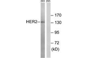 Western blot analysis of extracts from 293 cells, treated with Ca2+ 40nM 30', using HER2 (Ab-1112) Antibody. (ErbB2/Her2 anticorps  (AA 1081-1130))