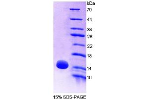 SDS-PAGE analysis of Mouse OT Protein.