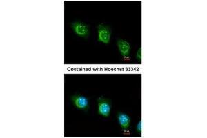 ICC/IF Image Immunofluorescence analysis of methanol-fixed HeLa, using USP47, antibody at 1:200 dilution. (USP47 anticorps)