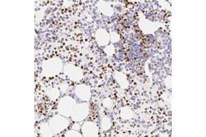 Immunohistochemical staining (Formalin-fixed paraffin-embedded sections) of human bone marrow with PADI4 polyclonal antibody  shows strong cytoplasmic and nuclear positivity in subset of hematopoietic cells. (PAD4 anticorps)