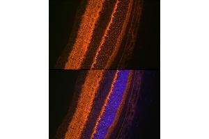 Immunofluorescence analysis of rat eye using V Rabbit mAb (ABIN7271313) at dilution of 1:100 (40x lens). (VAMP2 anticorps)
