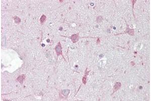 Brain stained in IHC-P with GABRA1 antibody