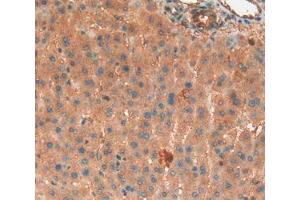 IHC-P analysis of Liver Tissue, with DAB staining. (Haptoglobin anticorps  (AA 104-346))