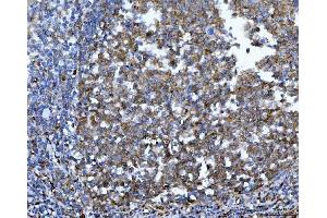 IHC analysis of YWHAE using anti-YWHAE antibody (ABIN7599165). (YWHAE anticorps  (AA 1-255))
