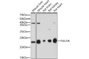 Western blot analysis of extracts of various cell lines, using NDUFS4 Rabbit mAb (ABIN7268821) at 1:1000 dilution. (NDUFS4 anticorps)