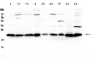 Western blot analysis of HP1 gamma using anti-HP1 gamma antibody . (CBX3 anticorps  (AA 2-183))