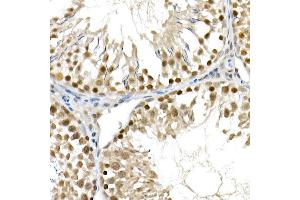 Immunohistochemistry of paraffin-embedded mouse stomach using α-Smooth Muscle Actin  Rabbit pAb (ABIN6127402, ABIN6136473, ABIN6136476 and ABIN6214239) at dilution of 1:25 (40x lens).