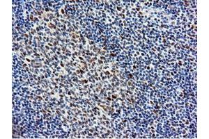 Image no. 16 for anti-5'-Nucleotidase Domain Containing 1 (NT5DC1) antibody (ABIN1499838)