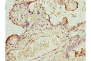 Immunohistochemistry of paraffin-embedded human placenta tissue using ABIN7146436 at dilution of 1:100 (CAMK1D anticorps  (AA 1-180))